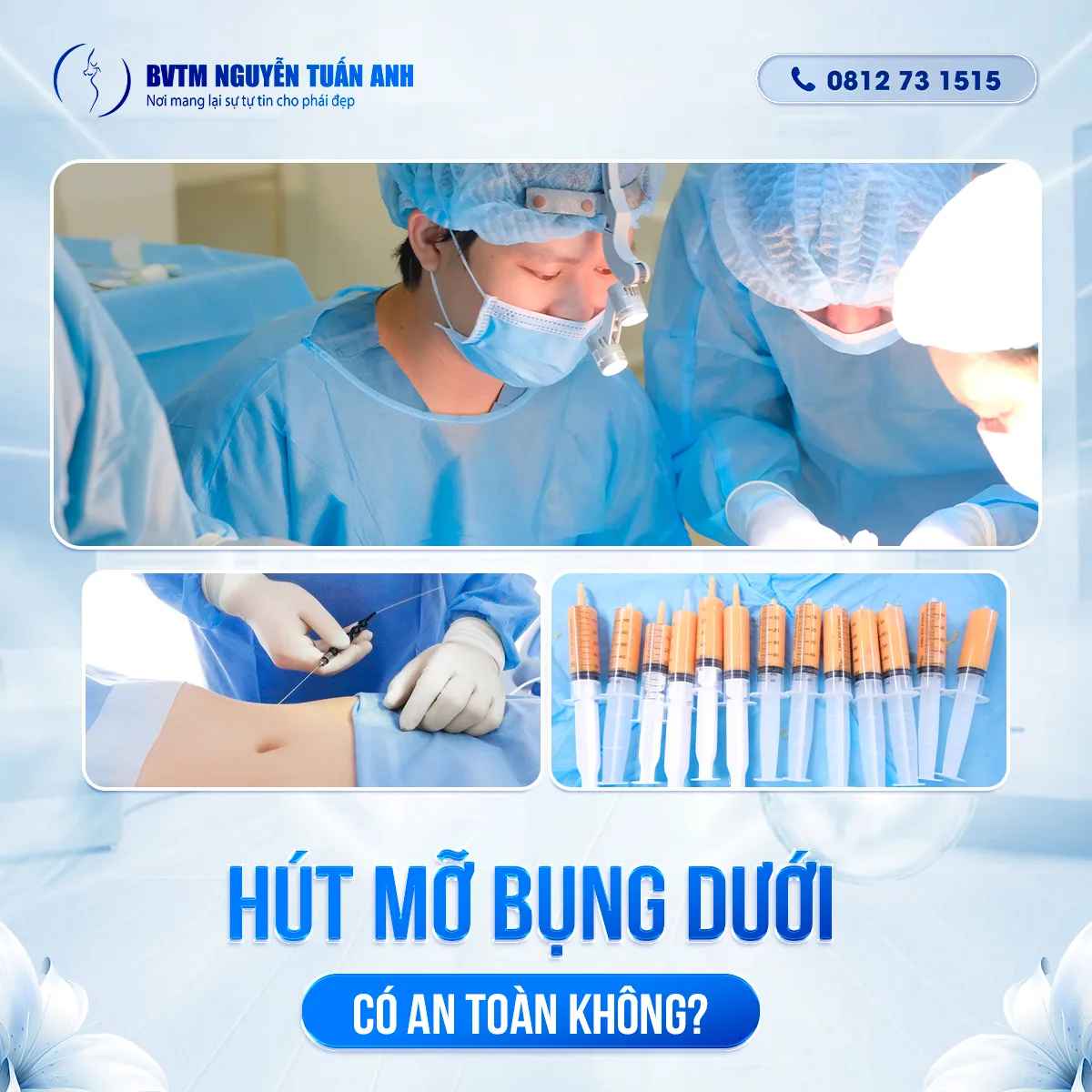 Hút mỡ bụng dưới có an toàn không?