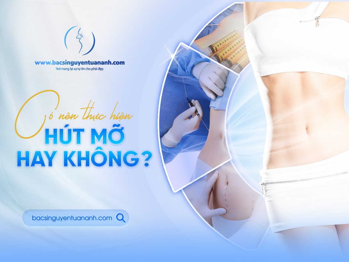 Những điều cần biết khi hút mỡ