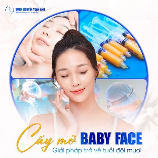 Trở về tuổi đôi mươi cùng giải pháp Cấy Mỡ Baby Face