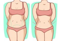 Hút mỡ bị lồi lõm có chỉnh sửa được không?