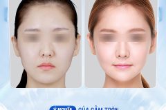 Cằm tròn đầy: Biểu tượng cuộc sống giàu sang viên mãn