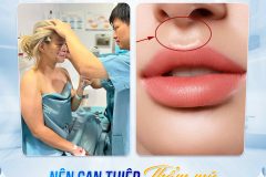 Nhân trung sâu dài nói lên điều gì