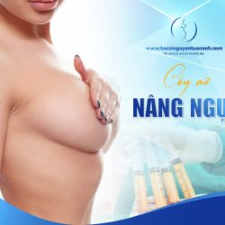 Cấy mỡ nâng ngực và những điều cần biết