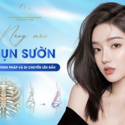 Nâng mũi cấu trúc sụn sườn