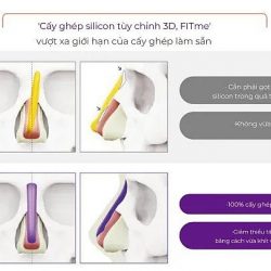 Xu hướng tạo dáng mũi cá nhân hóa hiện nay