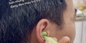 10 năm chịu đựng nghe kém để đi tìm một giải pháp đủ nhỏ gọn, đủ thẩm mỹ, đủ kín