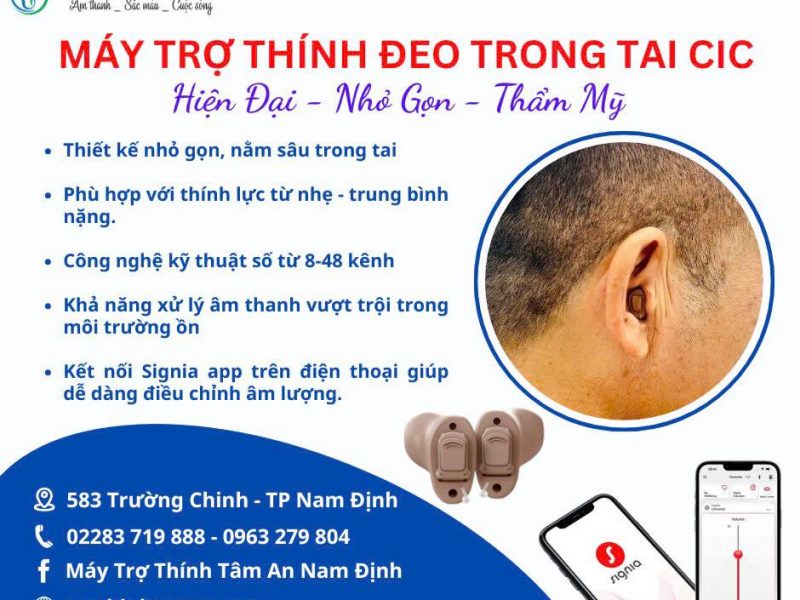 may-tro-thinh-deo-trong-tai-tham-my-cic