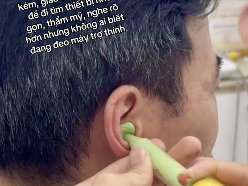 10-nam-chiu-dung-nghe-kem-de-di-tim-mot-giai-phap-du-nho-gon-du-tham-my-du-kin