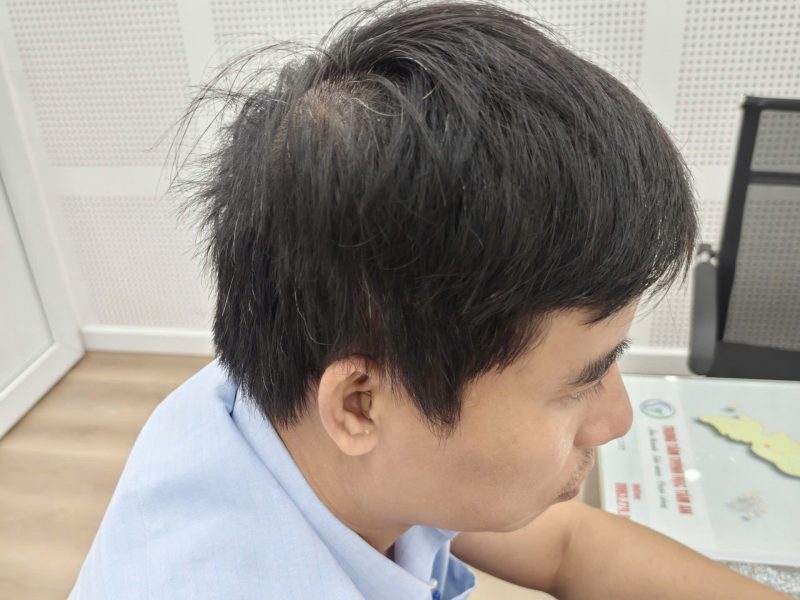 may-tro-thinh-signia-fast-p-mang-cong-nghe-duc-den-gan-hon-voi-ban