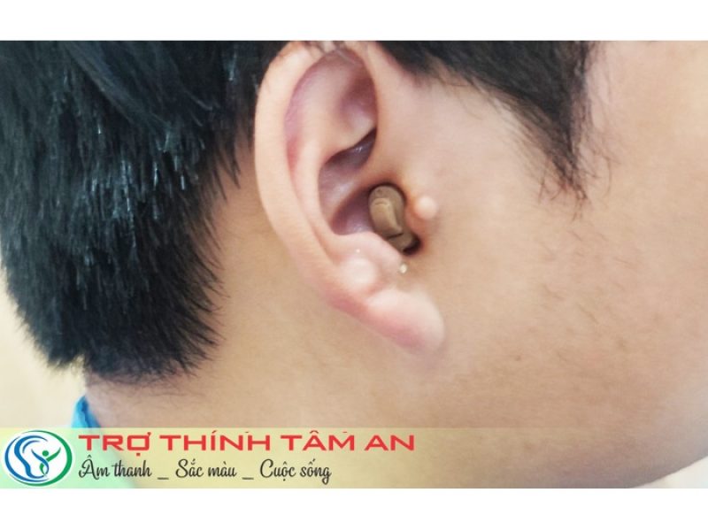 insio-2nx-cic-giai-phap-tro-thinh-kin-dao-cho-nguoi-yeu-su-tinh-te