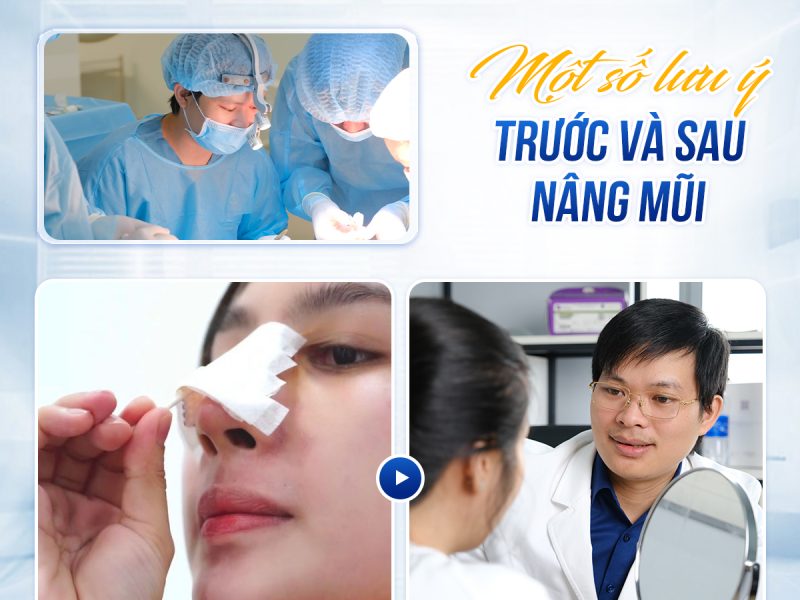 vi-sao-can-phai-su-dung-nep-mui-sau-phau-