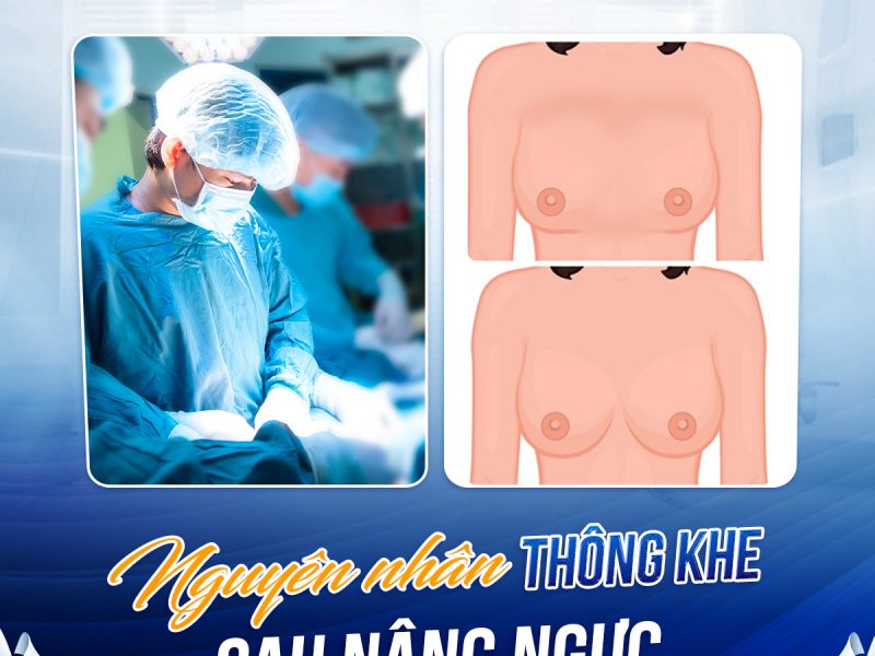 hieu-ro-ve-thong-khe-sau-nang-nguc