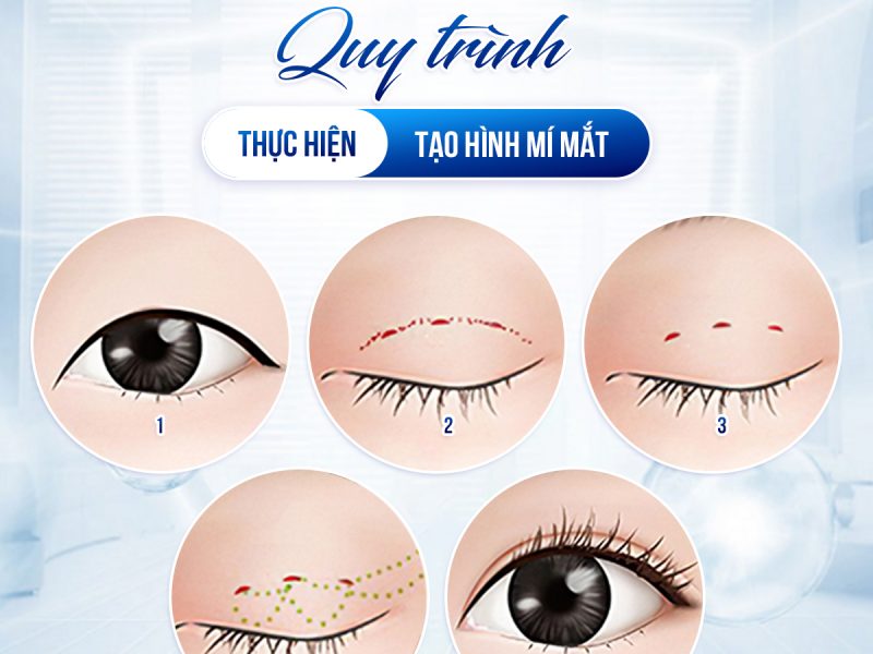 giai-phap-tao-nep-mi-tu-nhien-cho-nguoi-ban-ron