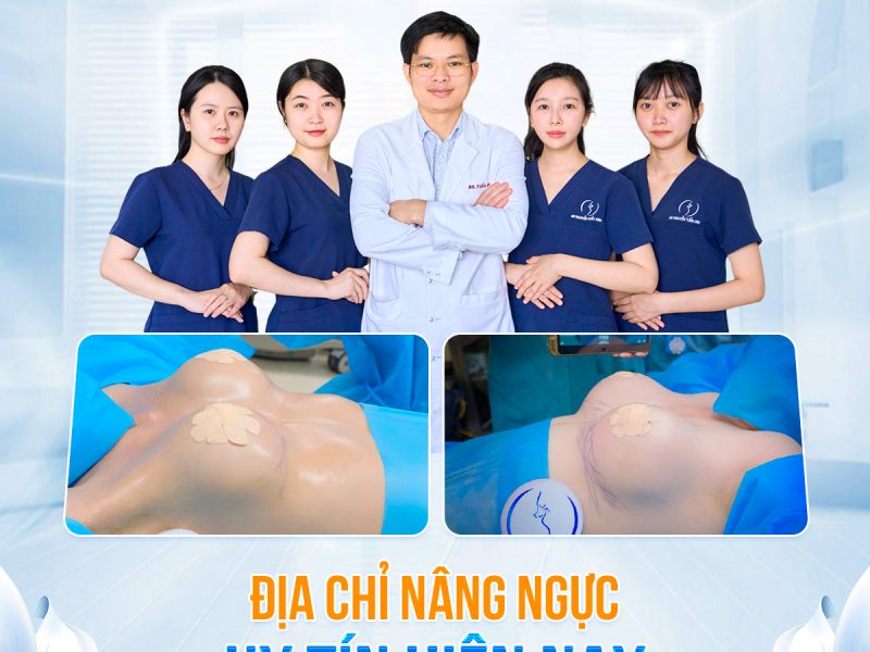 nang-nguc-noi-soi-la-gi-dia-chi-nang-nguc-uy-tin-hien-nay