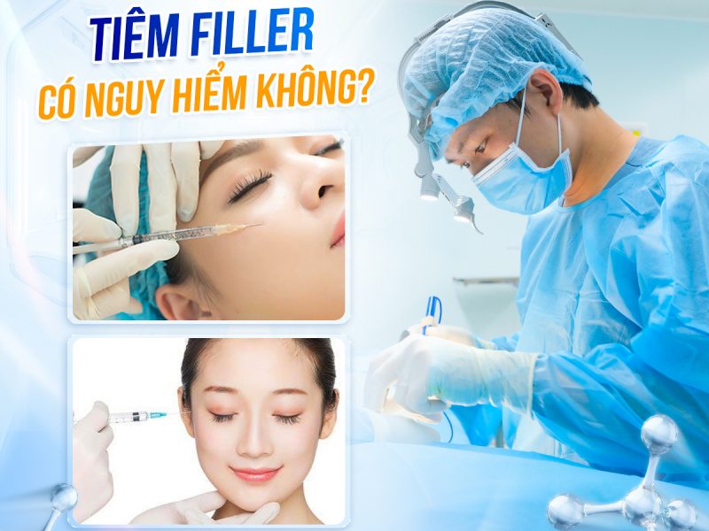 tiem-filler-la-gi-va-vi-sao-lai-duoc-ua-chuong-