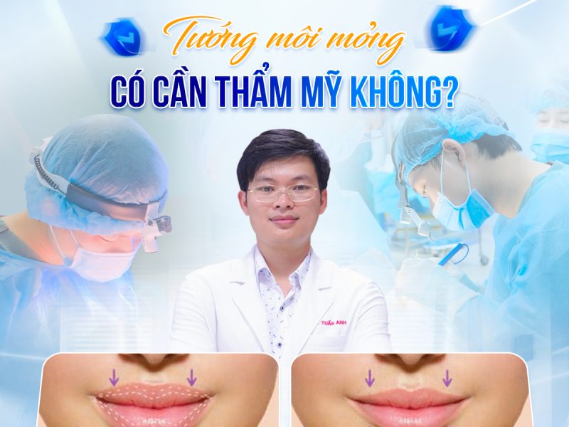 tuong-moi-mong