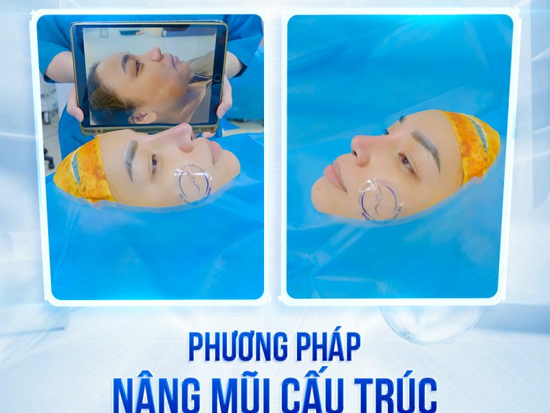 nang-mui-sun-tai-co-gay-nguy-hiem-khong