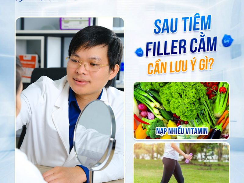 sau-khi-tiem-filler-cam-can-luu-y-gi-