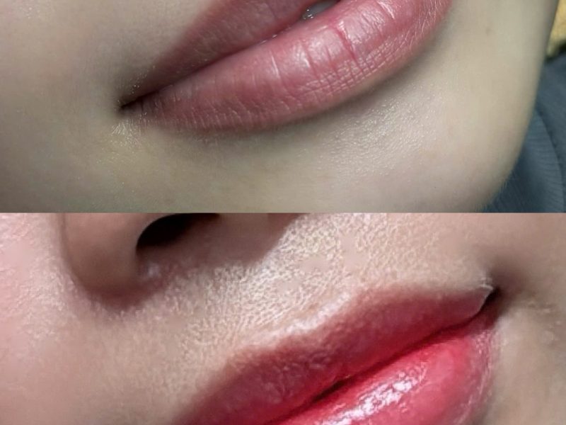 combo-xu-ly-tham-va-phun-moi-choushi-giai-phap-cho-doi-moi-tuoi-tan-tu-nhien