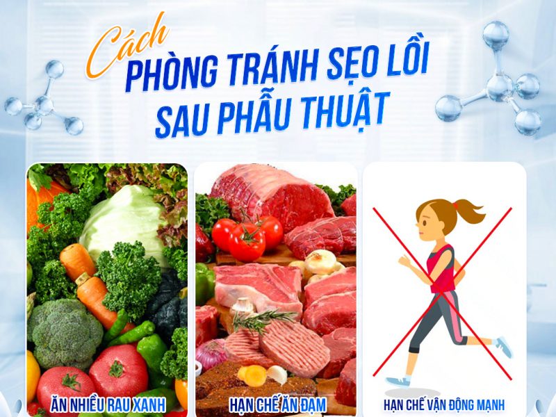 cat-mi-bi-loi-seo-co-khac-phuc-duoc-khong-