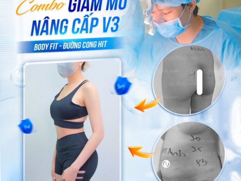 combo-giam-mo-nang-cap-vong-3