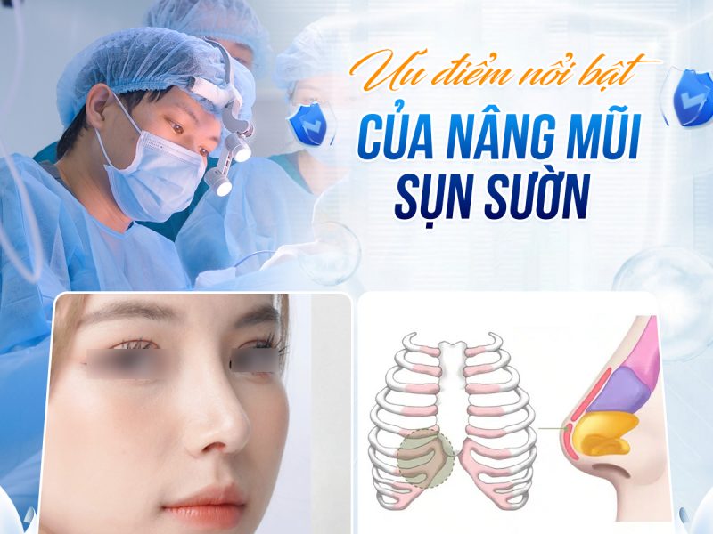 nang-mui-sun-suon-co-ben-lau-khong