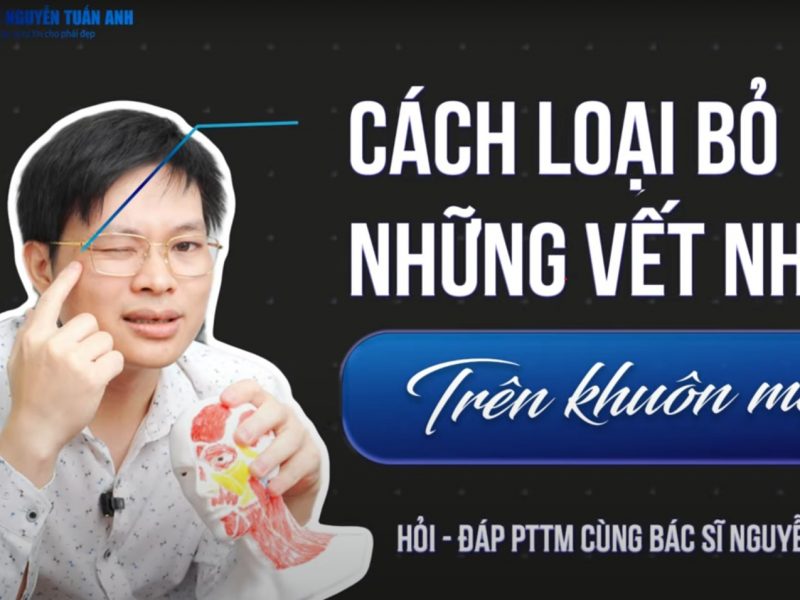 nep-nhan-tren-khuon-mat