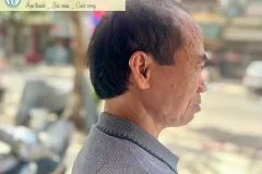 Lựa chọn máy trợ thính cho người cao tuổi tại Hưng Yên