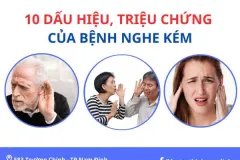 10 Dấu hiệu, triệu chứng của bệnh nghe kém