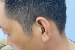 Máy trợ thính trong tai bí mật giá 2,800,000 VNĐ tại Hưng