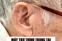 Máy trợ thính Tết ý nghĩa tại Ninh Bình