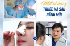 Vì sao cần phải sử dụng nẹp mũi sau phẫu?