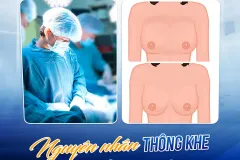 Thông khe sau nâng ngực tại TP. Hồ Chí Minh