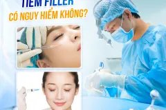 Tiêm Filler là gì và vì sao lại được ưa thích