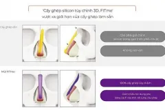 Nâng mũi 3D Fitme tại Thành phố Hồ Chí Minh