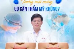 Tướng Môi Mỏng