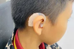 Tác động của nghe kém đến sự phát triển trẻ em tại Hưng Yên