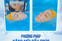 Nâng Mũi Sụn Tai Có Gây Nguy Hiểm Không