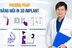 Giải pháp tạo dáng mũi chuẩn cá nhân hóa