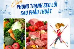 Cắt mí bị lồi sẹo có khắc phục được không?
