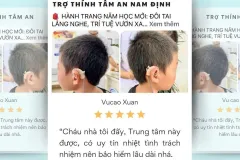 Dịch vụ chăm sóc sức khỏe thính lực tại Ninh Bình 2,8 triệu
