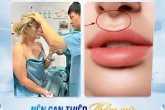 Nhân trung sâu dài nói lên điều gì