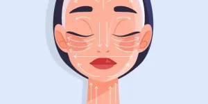 Căng da mặt toàn phần an toàn hay tiềm ẩn rủi ro