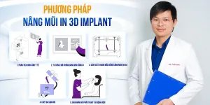 Giải pháp tạo dáng mũi chuẩn cá nhân hóa