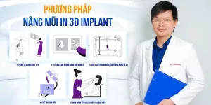 Giải pháp tạo dáng mũi chuẩn cá nhân hóa